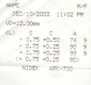 Receipt of IntraOcular Pressure measurements